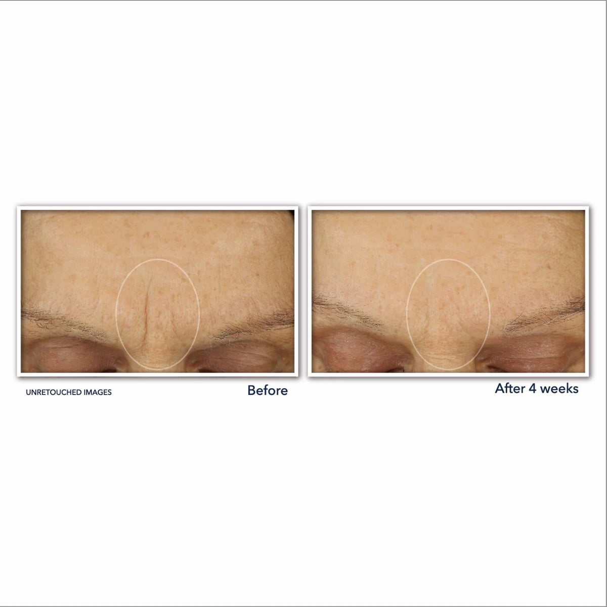Retinol Anti-Aging Cream with Hyaluronic Acid, Fragrance-Free 1.7 oz T9224