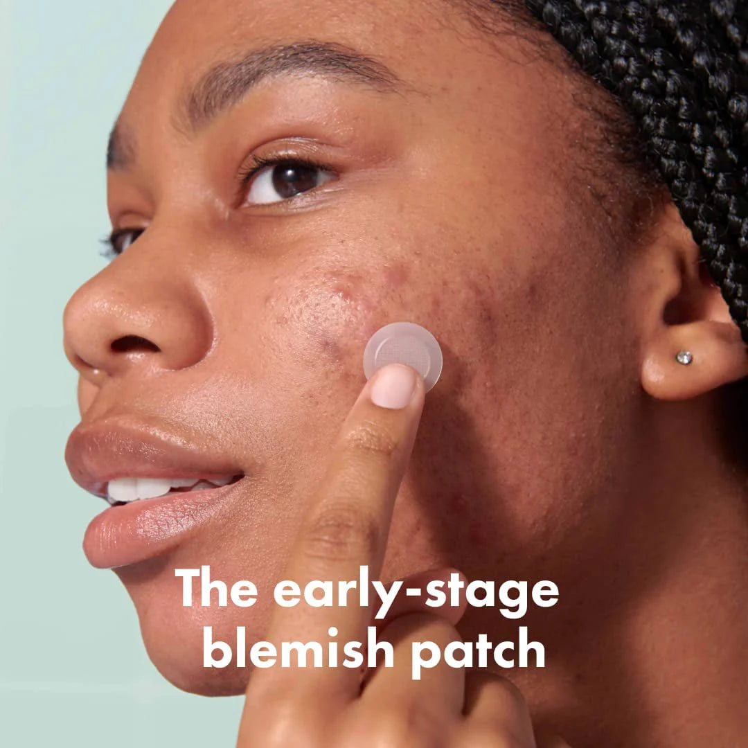 Hydrocolloid Acne Spot Treatment Patch 8 Patches L537166